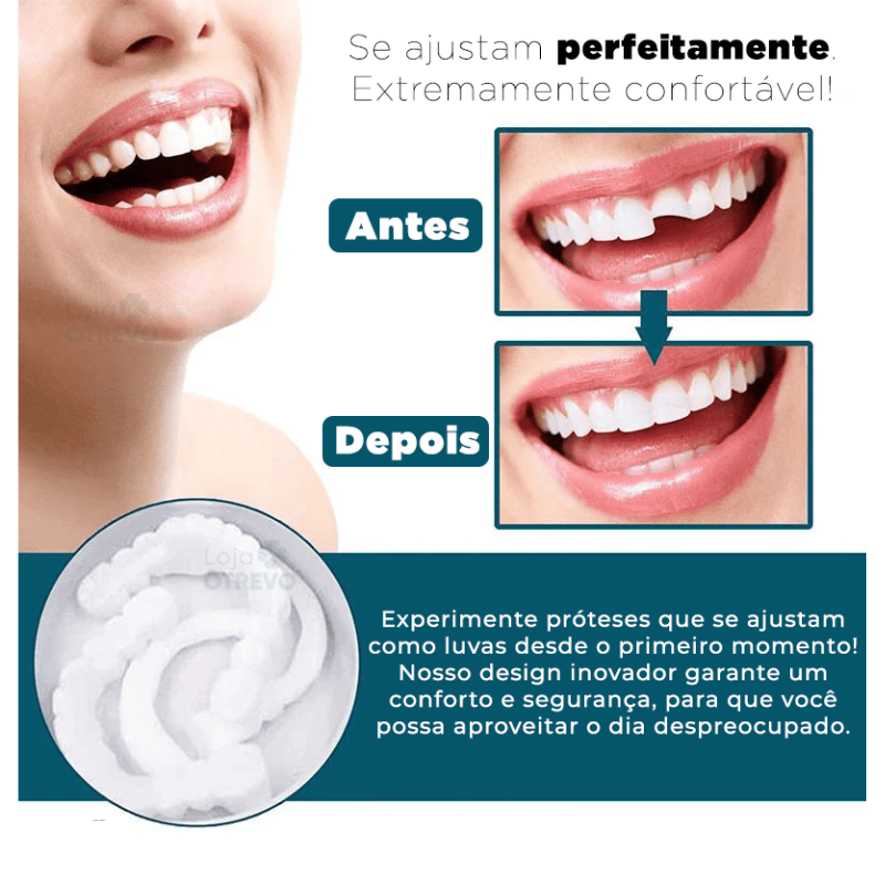 SmileFit® - Facetas Dentárias Naturais Removíveis